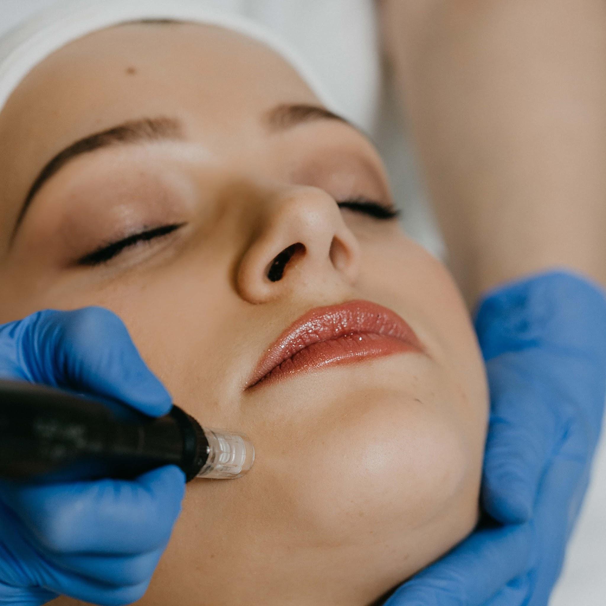 Gentle Care Laser Facials