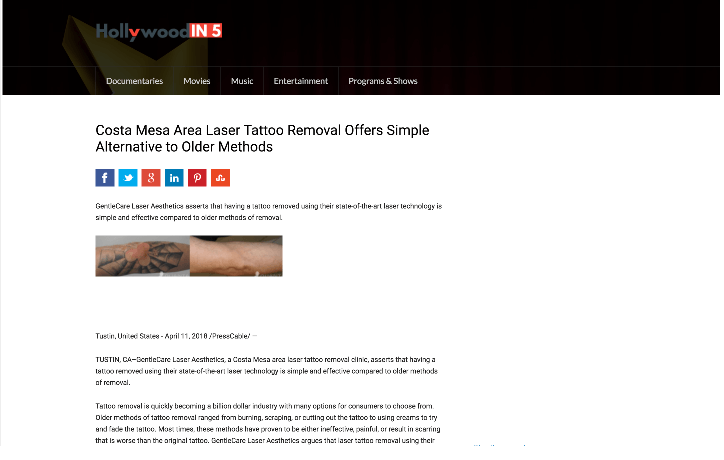 gentle laser care tustin in press release