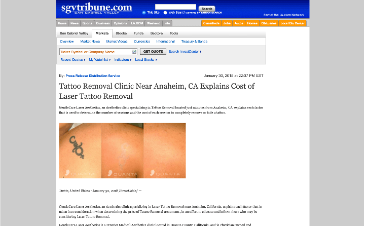 gentle laser care tustin in press release