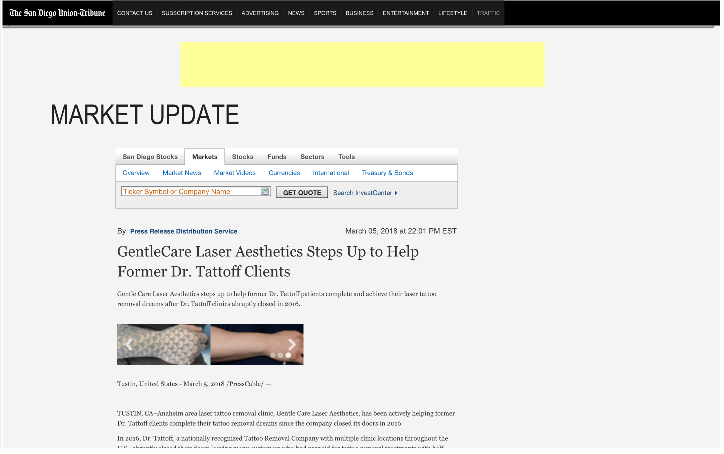 gentle laser care tustin in press release