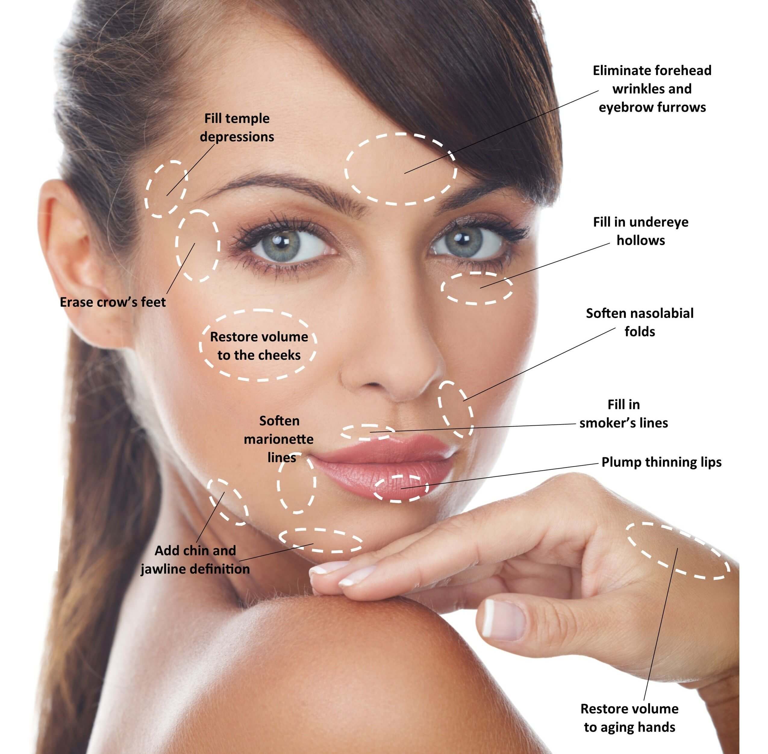 Carbon peel gentle laser care aesthetics tustin california