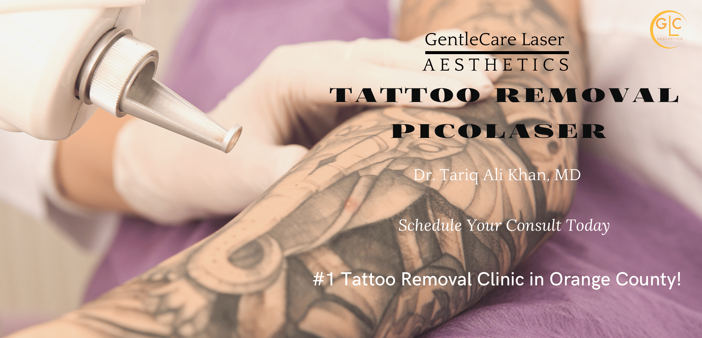 Best Tattoo Removal in Roorkee, Laser Tattoo Removal Services