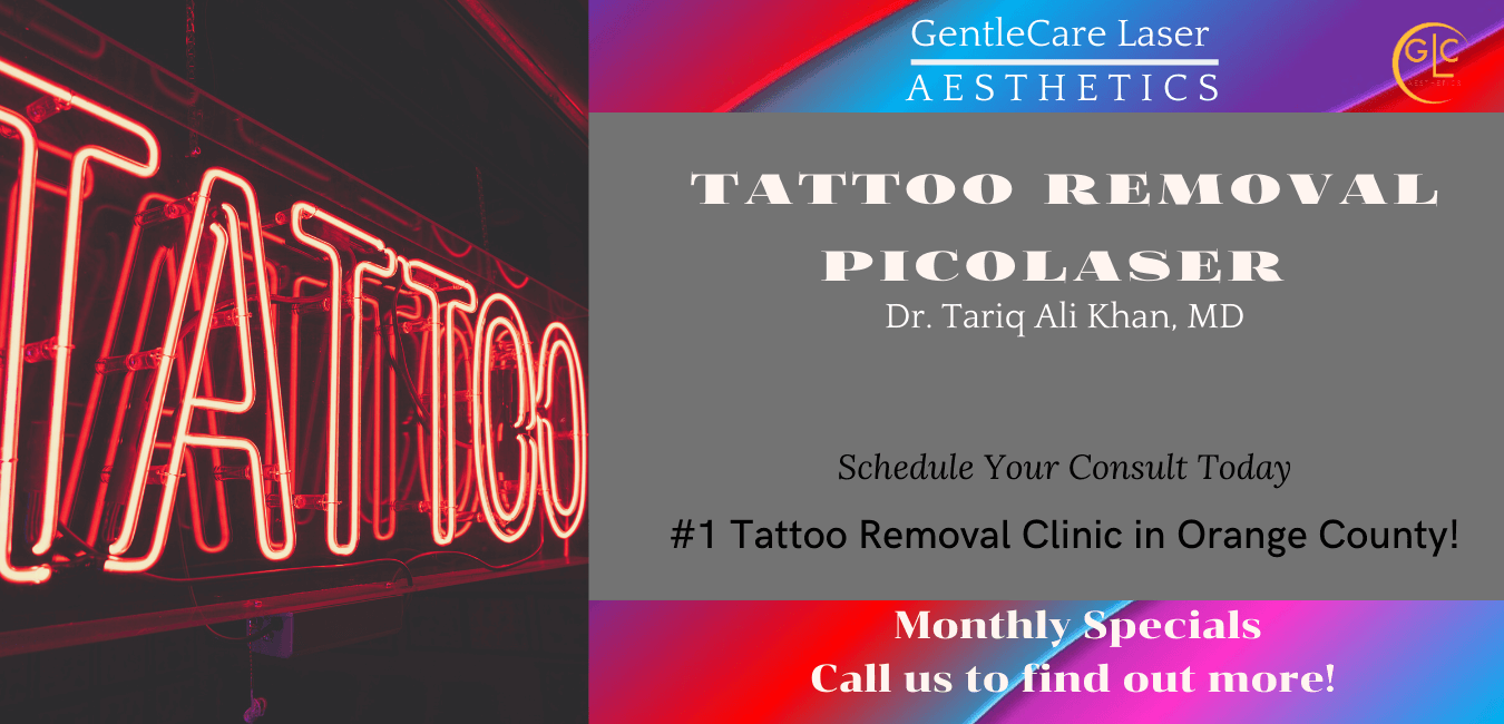 laser tattoo removal best in organe county Gentle care Laser aesthetics